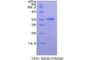 SDS-PAGE analysis of Mouse RELB Protein. (RELB 蛋白)