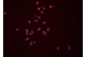 ABIN6259977 and ABIN6276522 staining HEPG2 cells by ICC/IF.