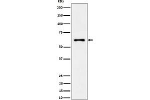Western blot analysis of EYA2 expression in 293T cell lysate.