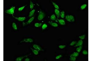 Immunofluorescence staining of Hela cells with ABIN7150414 at 1:66, counter-stained with DAPI. (CD3EAP 抗体  (AA 289-404))