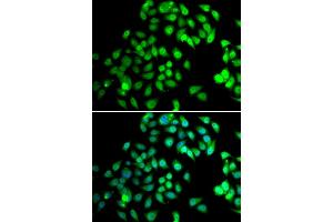 Immunofluorescence analysis of MCF-7 cells using NCBP2 antibody (ABIN5974395). (NCBP2 抗体)