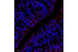 Immunofluorescence of paraffin embedded mouse colon using NCK (ABIN7074783) at dilution of 1:1000 (250x lens) (NCK2 抗体)