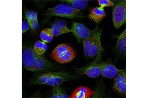 Immunofluorescence (IF) image for anti-BCL2-Like 1 (BCL2L1) (pSer62) antibody (ABIN1870015) (BCL2L1 抗体  (pSer62))