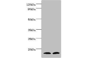 Western blot All lanes: Protachykinin-1 antibody at 6 μg/mL Lane 1: Mouse liver tissue Lane 2: 293T whole cell lysate Secondary Goat polyclonal to rabbit IgG at 1/10000 dilution Predicted band size: 16, 14, 12 kDa Observed band size: 16 kDa