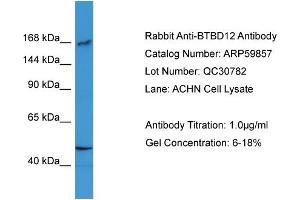 WB Suggested Anti-BTBD12  Antibody Titration: 0. (BTBD12 抗体  (N-Term))