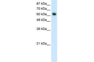 Western Blotting (WB) image for anti-Forkhead Box G1 (FOXG1) antibody (ABIN2461750) (FOXG1 抗体)