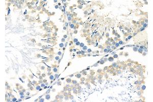 ABIN6257182 and ABIN6273598 at 1/100 staining Rat testis tissue by IHC-P. (FN3K 抗体  (Internal Region))