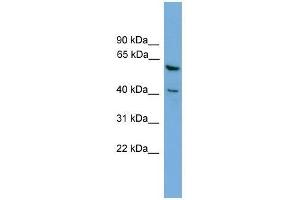 PINX1 antibody used at 0. (PINX1 抗体  (Middle Region))