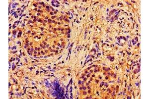 Immunohistochemistry (IHC) image for anti-ATP-Binding Cassette, Sub-Family B (MDR/TAP), Member 7 (ABCB7) (AA 23-140) antibody (ABIN7144893)
