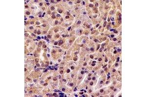 Immunohistochemical analysis of ABAT staining in rat kidney formalin fixed paraffin embedded tissue section. (ABAT 抗体)