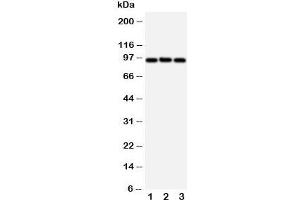Western blot testing of ABCB6 antibody and Lane 1:  HeLa;  2: MCF-7;  3: A549 cell lysate. (ABCB6 抗体  (C-Term))