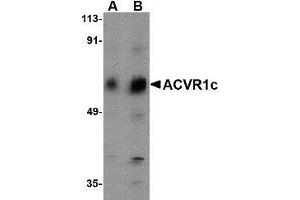 Western blot analysis of ACVR1C in human placenta tissue lysate with AP30016PU-N ACVR1C antibody at (A) 1 and (B) 2 μg/ml. (ACVR1C/ALK7 抗体  (N-Term))