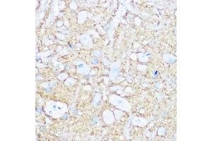 Immunohistochemistry (IHC) image for anti-Neural Cell Adhesion Molecule 1 (NCAM1) (AA 759-858) antibody (ABIN6144393)