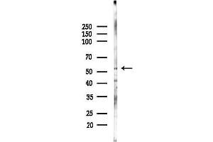 anti-NGFI-A Binding Protein 2 (EGR1 Binding Protein 2) (NAB2) (C-Term) antibody