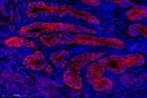 Immunofluorescent analysis of paraformaldehyde-fixed mouse uterus using,NCKAP1 (ABIN7074784) at dilution of 1: 1000 (NCKAP1 抗体)