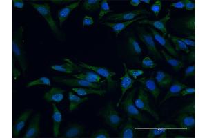 Immunofluorescence of purified MaxPab antibody to SMN2 on HeLa cell. (SMN2 抗体  (AA 1-282))