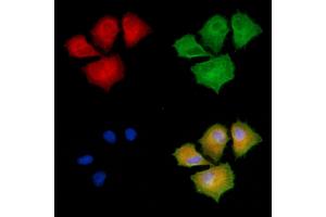 ABIN6257942 and ABIN6275202 staining  cells by IF/ICC.