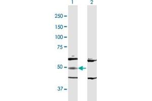 Western Blot analysis of ADSL expression in transfected 293T cell line by ADSL MaxPab polyclonal antibody. (Adenylosuccinate Lyase 抗体  (AA 1-484))