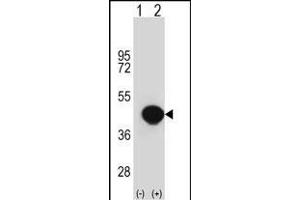 Western blot analysis of BGN (arrow) using rabbit polyclonal BGN Antibody (Center) (ABIN390701 and ABIN2840987). (Biglycan 抗体  (AA 148-176))