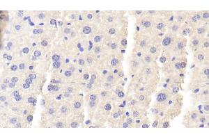 Detection of BGN in Mouse Liver Tissue using Polyclonal Antibody to Biglycan (BGN) (Biglycan 抗体  (AA 53-166))
