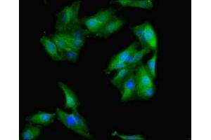 Immunofluorescent analysis of Hela cells using ABIN7142719 at dilution of 1:100 and Alexa Fluor 488-congugated AffiniPure Goat Anti-Rabbit IgG(H+L) (50S Ribosomal Protein L16 (RplP) (AA 1-317) 抗体)