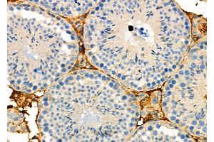 ABIN6263947 and ABIN6272732 at 1/100 staining Mouse testis tissue by IHC-P. (P2RY1 抗体  (C-Term))