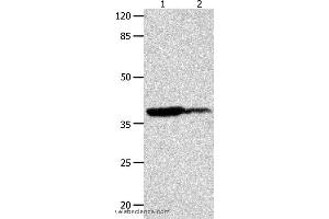 Western blot analysis of Human leiomyosarcoma and liver cancer tissue  , using LPAR4 Polyclonal Antibody at dilution of 1:450 (LPAR4 抗体)