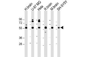 All lanes : Anti-GDI1 Antibody (C-term) at 1:2000 dilution Lane 1: human brain lysate Lane 2: U-87 MG whole cell lysate Lane 3: Hela whole cell lysate Lane 4: rat brain lysate Lane 5: mouse brain lysate Lane 6: SH-SY5Y whole cell lysate Lysates/proteins at 20 μg per lane. (GDI1 抗体  (C-Term))