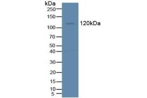 Detection of Tie1 in Human K562 Cells using Polyclonal Antibody to Tyrosine Kinase With Immunoglobulin Like And EGF Like Domains Protein 1 (Tie1) (TIE1 抗体  (AA 435-609))