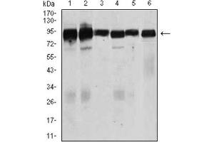 Western Blotting (WB) image for anti-Transforming Growth Factor, beta Receptor III (TGFBR3) (AA 147-328) antibody (ABIN1846465) (TGFBR3 抗体  (AA 147-328))