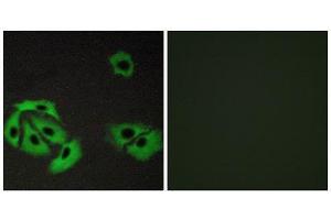 Immunofluorescence (IF) image for anti-BCL2-Associated X Protein (BAX) (Internal Region) antibody (ABIN5977240) (BAX 抗体  (Internal Region))