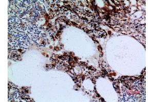 Immunohistochemistry (IHC) analysis of paraffin-embedded Human Lung, antibody was diluted at 1:100. (17beta-HSD4 (N-Term) 抗体)