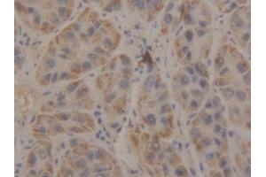 DAB staining on IHC-P; Samples: Human Liver Tissue (Manic Fringe 抗体  (AA 80-316))