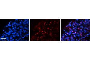 Rabbit Anti-WWP1 Antibody     Formalin Fixed Paraffin Embedded Tissue: Human Pineal Tissue  Observed Staining: Nuclear in pinealocytes  Primary Antibody Concentration: 1:100  Secondary Antibody: Donkey anti-Rabbit-Cy3  Secondary Antibody Concentration: 1:200  Magnification: 20X  Exposure Time: 0. (WWP1 抗体  (N-Term))