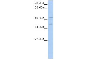 WB Suggested Anti-LASP1 Antibody Titration: 0. (LASP1 抗体  (Middle Region))