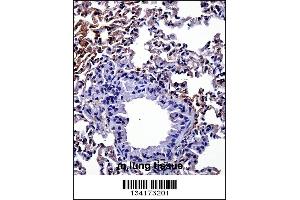 Mouse Hipk4 Antibody immunohistochemistry analysis in formalin fixed and paraffin embedded mouse lung tissue followed by peroxidase conjugation of the secondary antibody and DAB staining. (HIPK4 抗体  (C-Term))