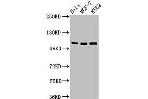 Western Blot Positive WB detected in: Hela whole cell lysate, MCF-7 whole cell lysate, K562 whole cell lysate All lanes: EVC antibody at 2 μg/mL Secondary Goat polyclonal to rabbit IgG at 1/50000 dilution Predicted band size: 112 kDa Observed band size: 112 kDa (EVC 抗体  (AA 493-602))