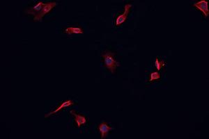 ABIN6266622 staining CACO-2 cells by IF/ICC. (PDGFRA 抗体  (Internal Region))