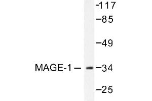 Image no. 1 for anti-Melanoma Antigen Family A, 1 (Directs Expression of Antigen MZ2-E) (MAGEA1) antibody (ABIN265510) (MAGEA1 抗体)