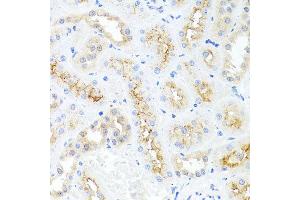 Immunohistochemistry of paraffin-embedded rat kidney using IL8 antibody at dilution of 1:100 (x40 lens). (IL-8 抗体)