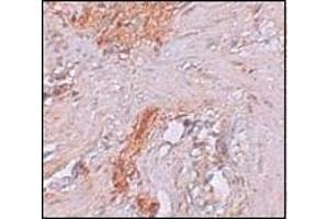 Immunohistochemistry of RBM35A in Human colon tissue with RBM35A antibody at 2. (ESRP1 抗体  (N-Term))