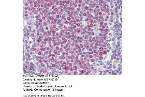 Immunohistochemistry (IHC) image for anti-Transforming Growth Factor beta 1 Induced Transcript 1 (TGFB1I1) (N-Term) antibody (ABIN2780989)