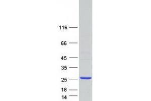 Western Blotting (WB) image for Ribonuclease P/MRP 25kDa Subunit (RPP25) protein (Myc-DYKDDDDK Tag) (ABIN2731154)