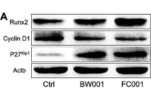 Effects of BW001 and FC001 on protein expression of the cyclin D1/Runx2 regulation network.