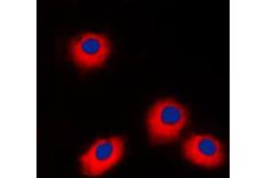 Immunofluorescent analysis of ERAS staining in Jurkat cells. (ERAS 抗体  (C-Term))