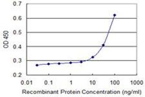 Detection limit for recombinant GST tagged PDXK is 3 ng/ml as a capture antibody. (PDXK 抗体  (AA 1-312))