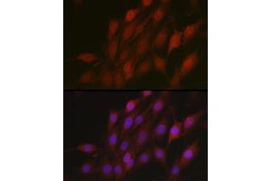 Immunofluorescence analysis of C6 cells using β-TrCP/BTRC Rabbit pAb (ABIN3022333, ABIN3022334, ABIN3022335 and ABIN6218745) at dilution of 1:100 (40x lens).