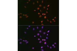 Immunofluorescence analysis of NIH-3T3 cells using SMC1 Rabbit mAb (ABIN7270614) at dilution of 1:100 (40x lens). (SMC1A 抗体)