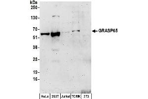 Western Blotting (WB) image for anti-Golgi Reassembly Stacking Protein 1, 65kDa (GORASP1) (AA 390-440) antibody (ABIN7449744)