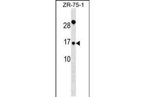 Western blot analysis in ZR-75-1 cell line lysates (35ug/lane). (TIMM9 抗体  (AA 18-44))